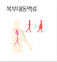 복부대동맥류