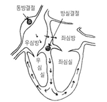 부정맥 이란