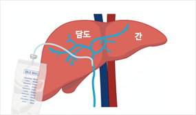 주머니에 연결된 간