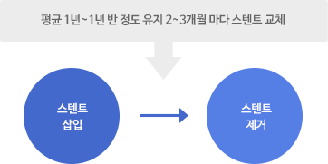 평균 1년~1년 반 정도 유지 2~3개월마다 스텐트 교체