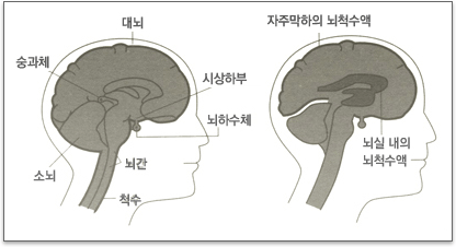 뇌종양의 원인을 규명하고 예전의 건강한 나를 되찾으세요 4
